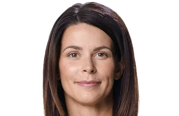 Juvederm Kelly (after)