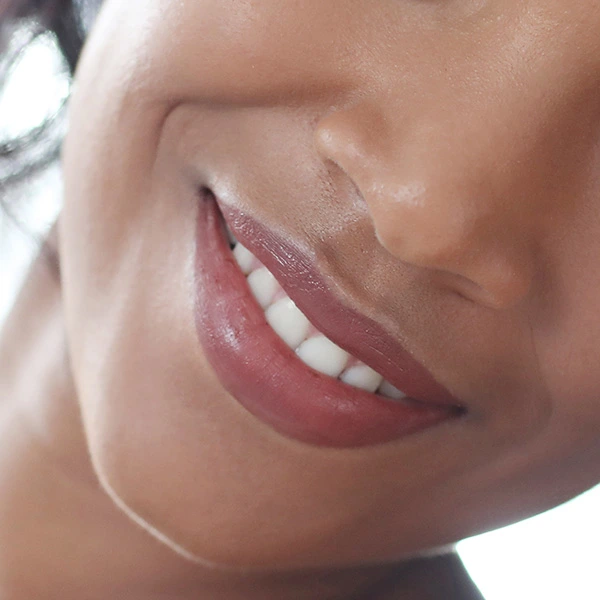 RHA 2 and RHA 3 natural refinement