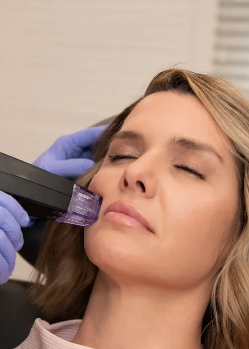 woman getting a morpheus8 microneedling treatment at a medical spa