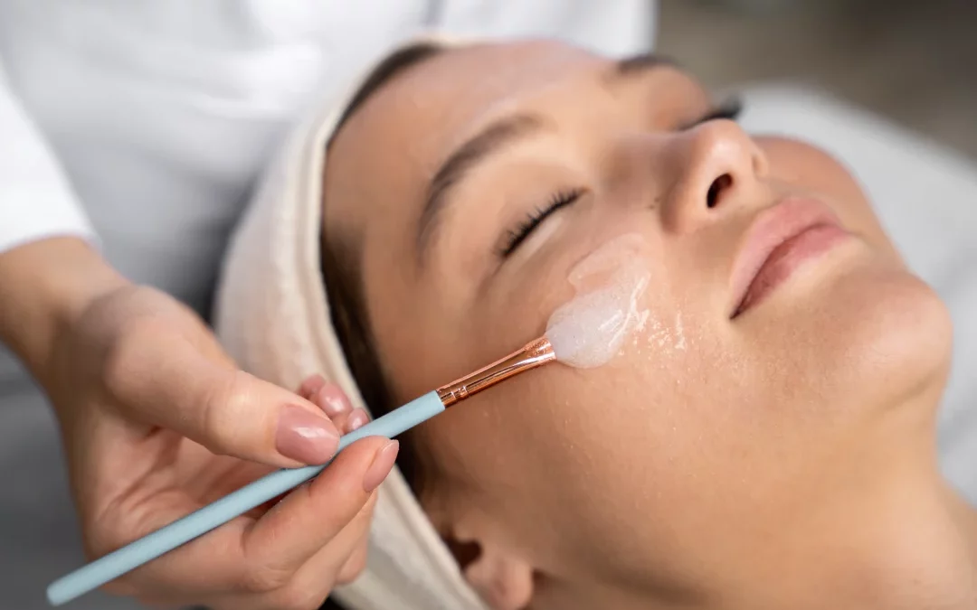 Chemical Peel Facial 101: The Benefits and What to Expect