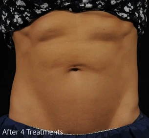 accufit-abs-image-5
